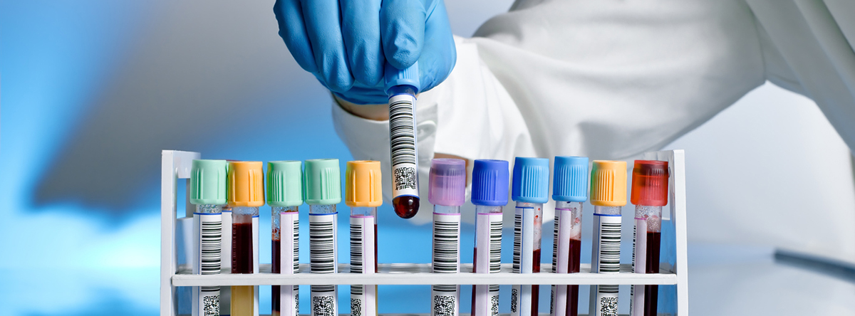 Oil Sample Turnaround